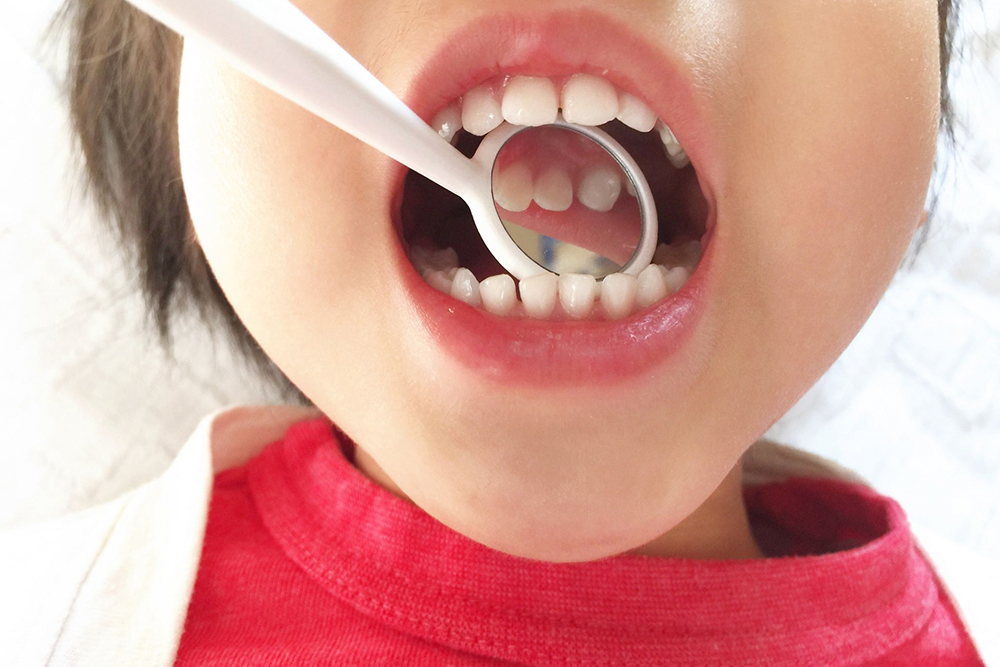 リスクと注意点