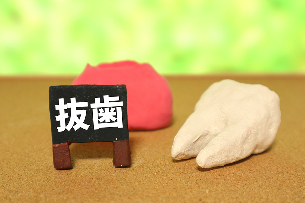 抜歯するケース